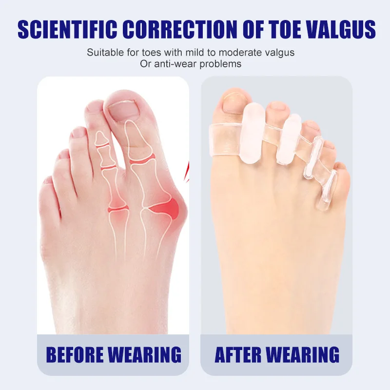 1 زوج سيليكون فاصل أصابع القدم - مراجعة Toe Separator Silicon وسعره