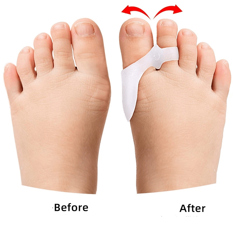 1/2/3Pairs الأطفال جل فاصل أصا - مراجعة Toe Separator Silicon وسعره