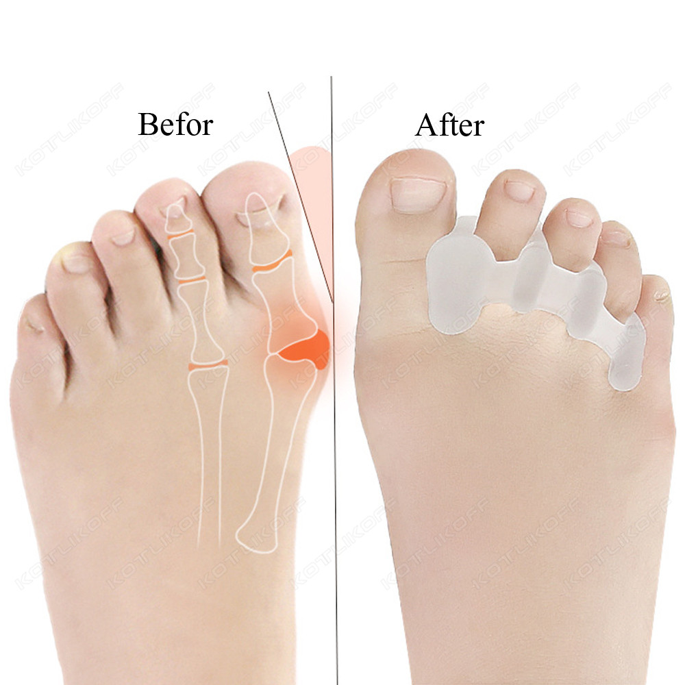 تو واقية أصابع فاصل سيليكون ال - مراجعة Toe Separator Silicon وسعره