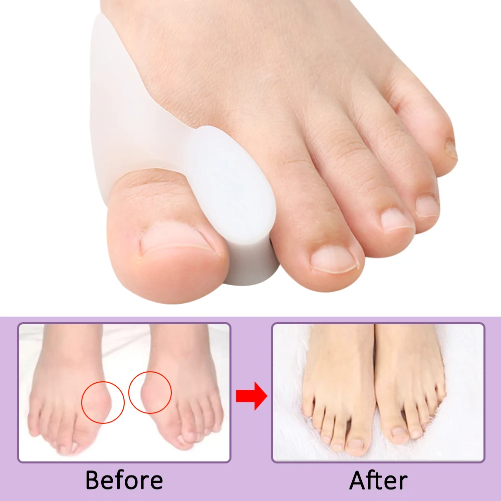 2/4/8 قطع فاصل أصابع القدم الج - مراجعة Toe Separator Silicon وسعره