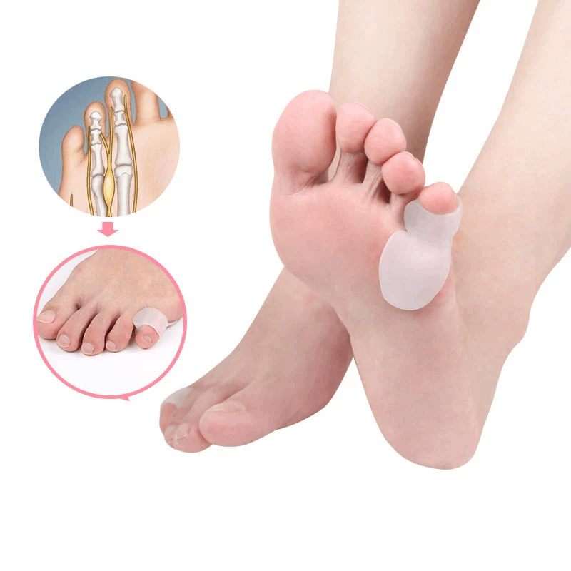 1/2/5 أزواج من واقي أصابع القد - مراجعة Toe Separator Silicon وسعره