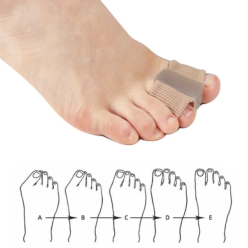 فواصل أصابع القدم من الجل مع ب - مراجعة Toe Separator Silicon وسعره